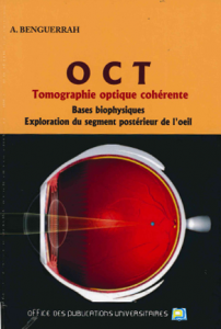 OCT Tomographie optique cohérente
