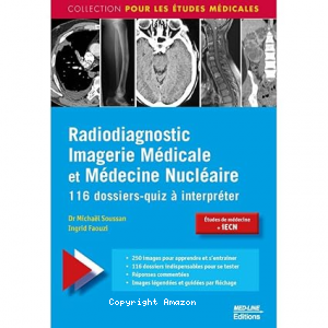 Radiodiagnostic imagerie médicale et médecine nucléaire
